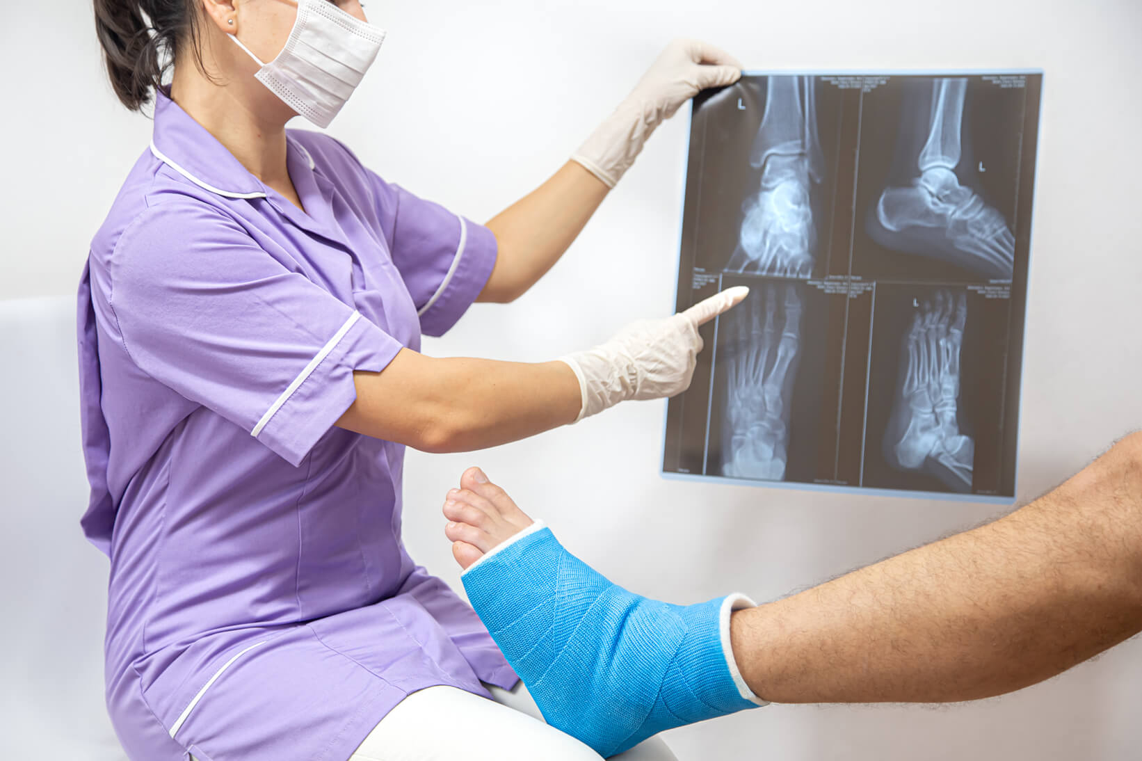 Doctora le enseña al paciente una radiografía del tobillo donde se aprecia una rotura ósea